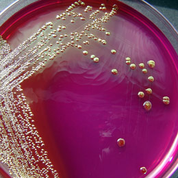 e coli oaie
